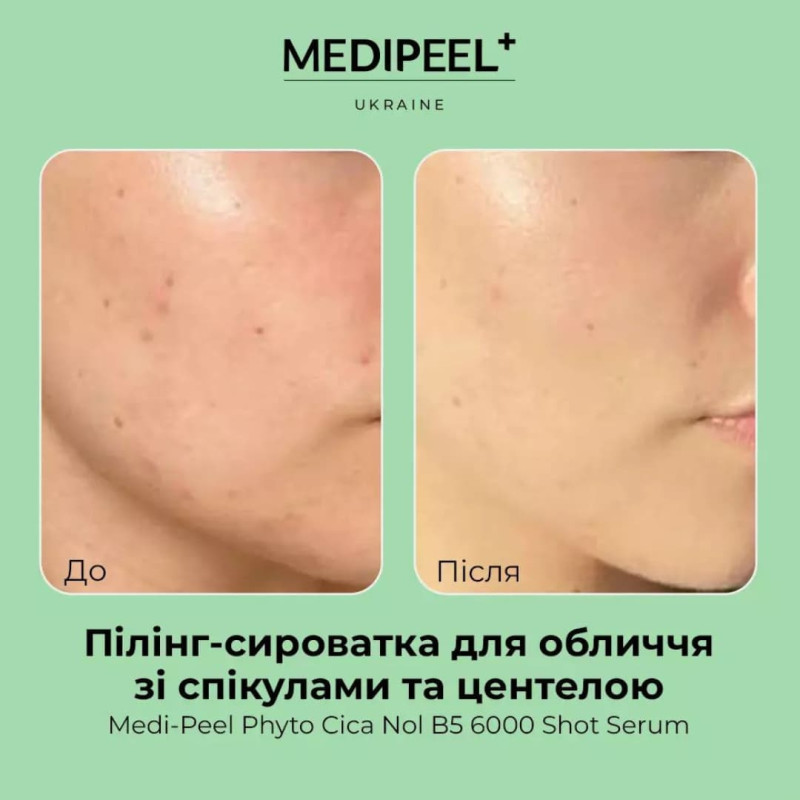 MEDIPEEL Сироватка-пілінг для обличчя зі спікулами та центеллою Phyto Cica Nol B5 6000 Shot Serum 50 мл