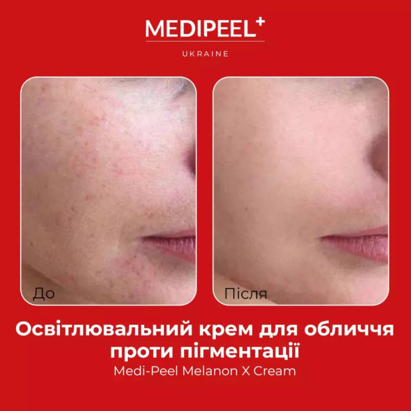 MEDIPEEL Крем освітлюючий проти пігментації Melanon X Cream 2.0 30 мл