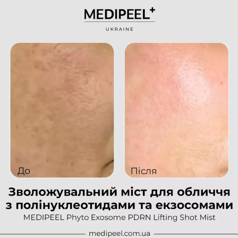 MEDIPEEL Міст-ліфтинг антивіковий для обличчя Phyto Exosome PDRN Lifting shot Mist 120 мл