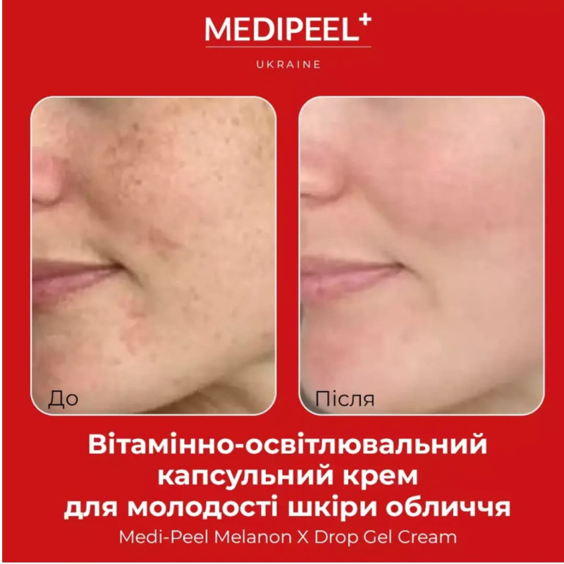 MEDIPEEL Крем-гель з ретинолом Melanon X Drop Gel Cream 50 мл